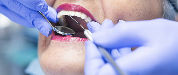 Best Emergency Denture Repair in Pearl River, NY